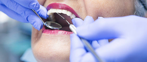 Best Emergency Gum Treatment in Chanhassen, MN